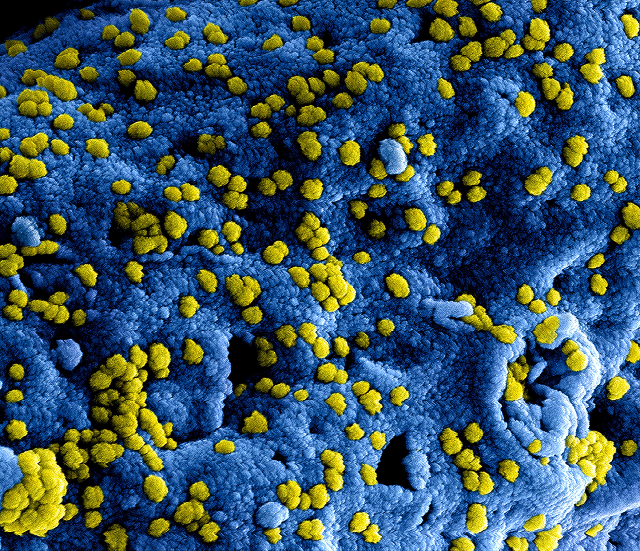 Verwonderend Coronavirus: FAQ's and the latest news | Saxion EZ-87